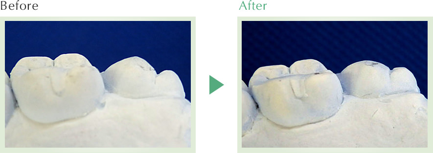 Before / After