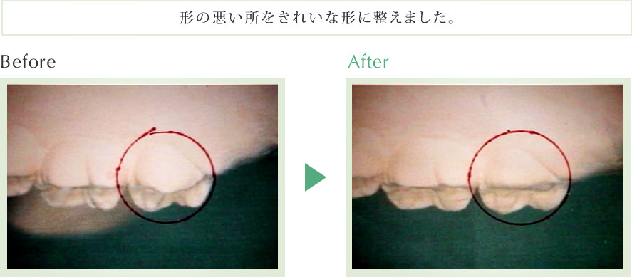 形の悪い所をきれいな形に整えました。
