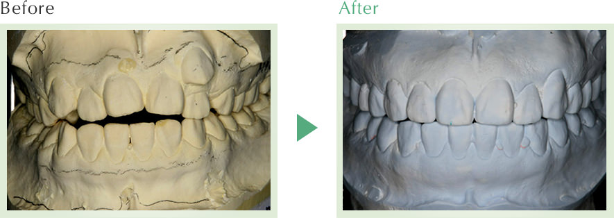 Before / After